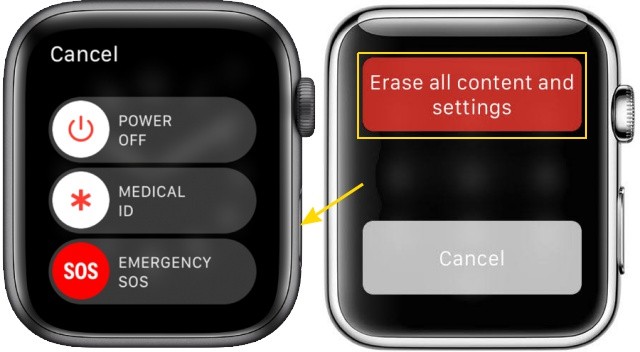 Quên Mật Khẩu Apple Watch? Khôi Phục Dễ Dàng Chỉ Với Vài Bước Đơn Giản
