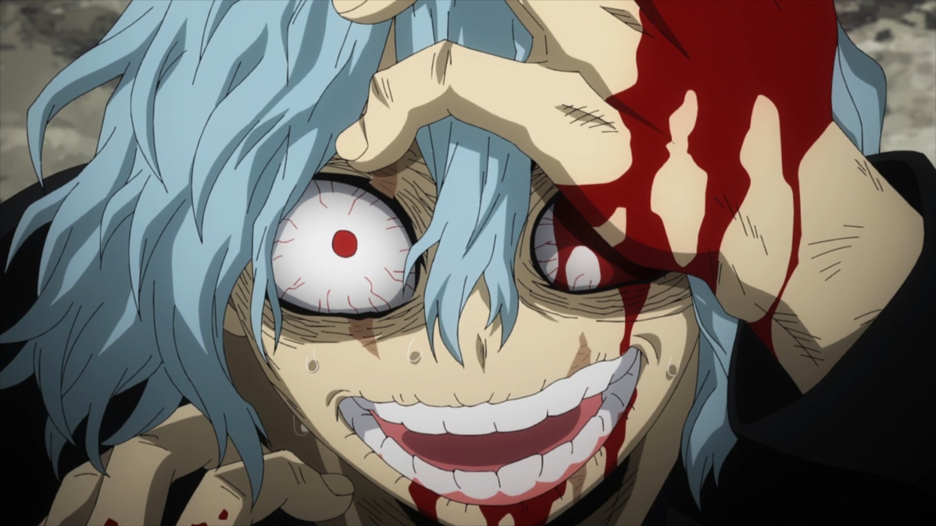 Tomura Shigaraki trong phần 5 của My Hero Academia